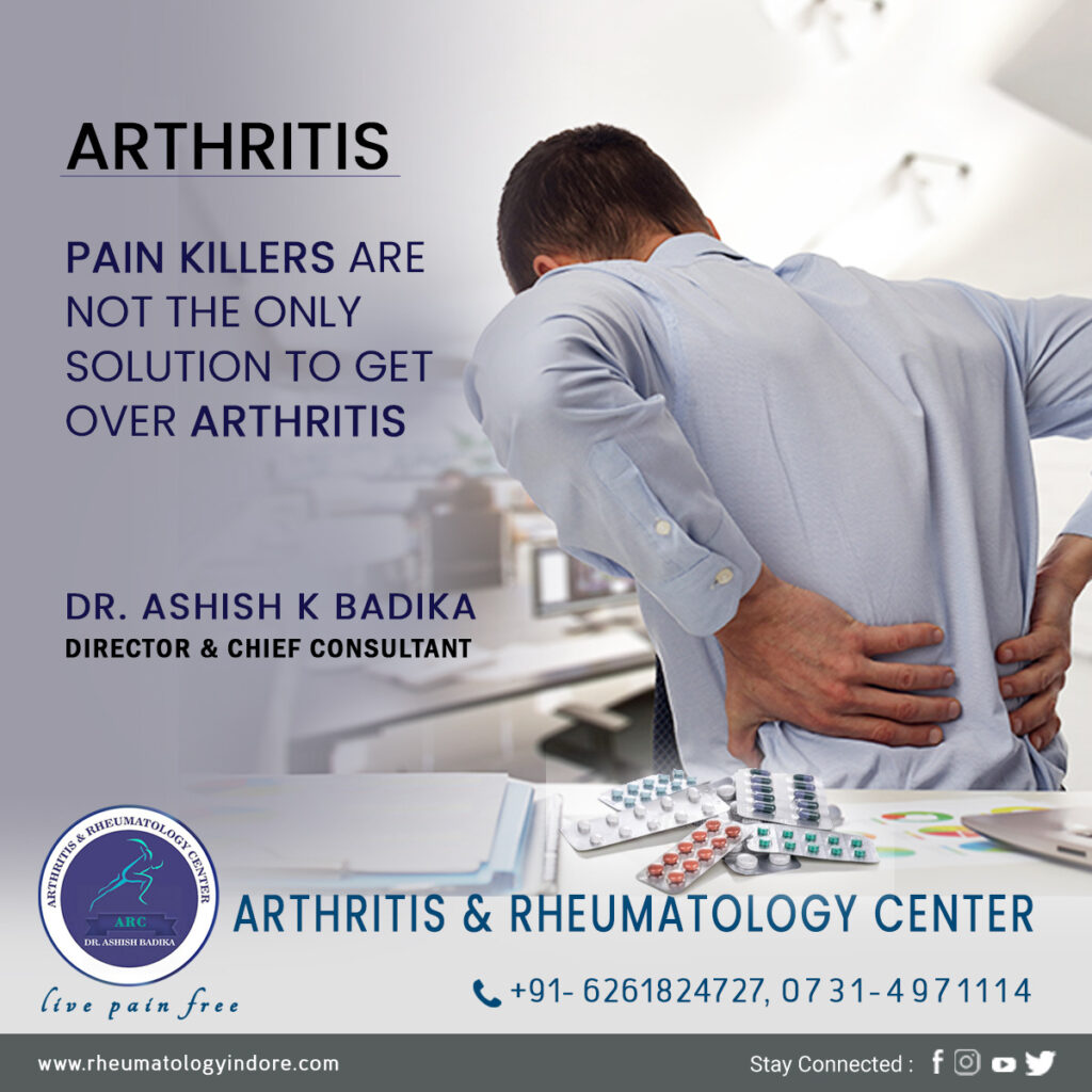 Arthritis Pain Relievers