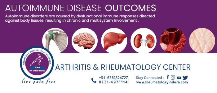 Autoimmune Diseases Outcome, Dr. Ashish Badika, rheumatologyindore.com