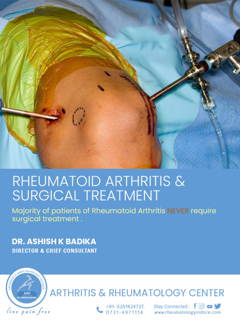 Rheumatoid Arthritis & Surgical Treatment in Indore - Dr. Ashish Badika
