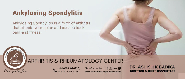 Ankylosing Spondylitis Symptoms, Dr. Ashish Badika, rheumatologyindore.com