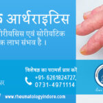 सोरियाटिक अर्थराइटिस का इलाज इंदौर में | Psoriatic Arthritis Treatment in Indore