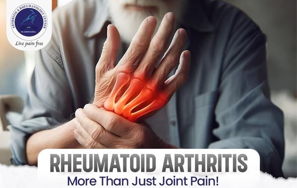 best rheumatology doctor in indore