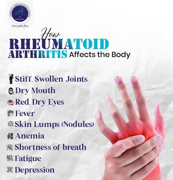 rheumatologist indore, rheumatologist in indore, best rheumatologist in indore