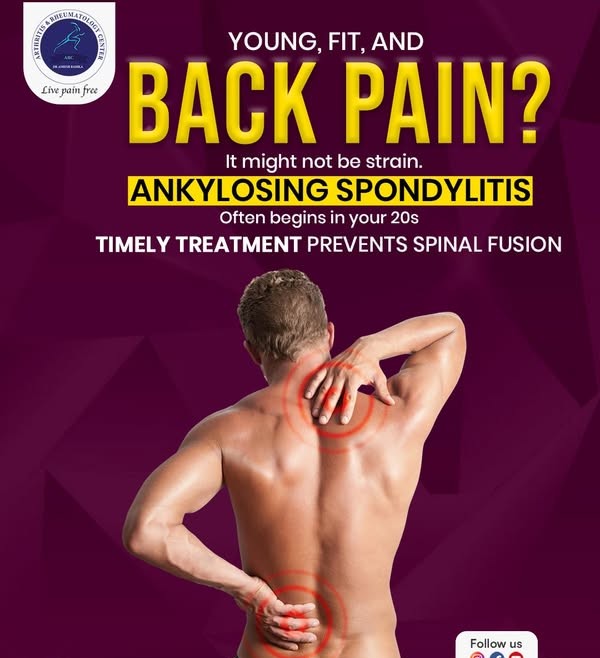 ankylosing spondylitis rheumatologist indore,